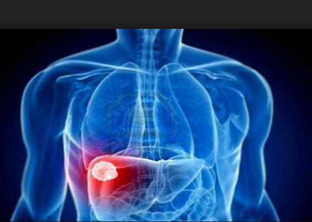 'وزارة الصحة: لهذه الأسباب ارتفعت حالات الإصابة بمرض التهاب الكبد الفيروسي صنف 'أ